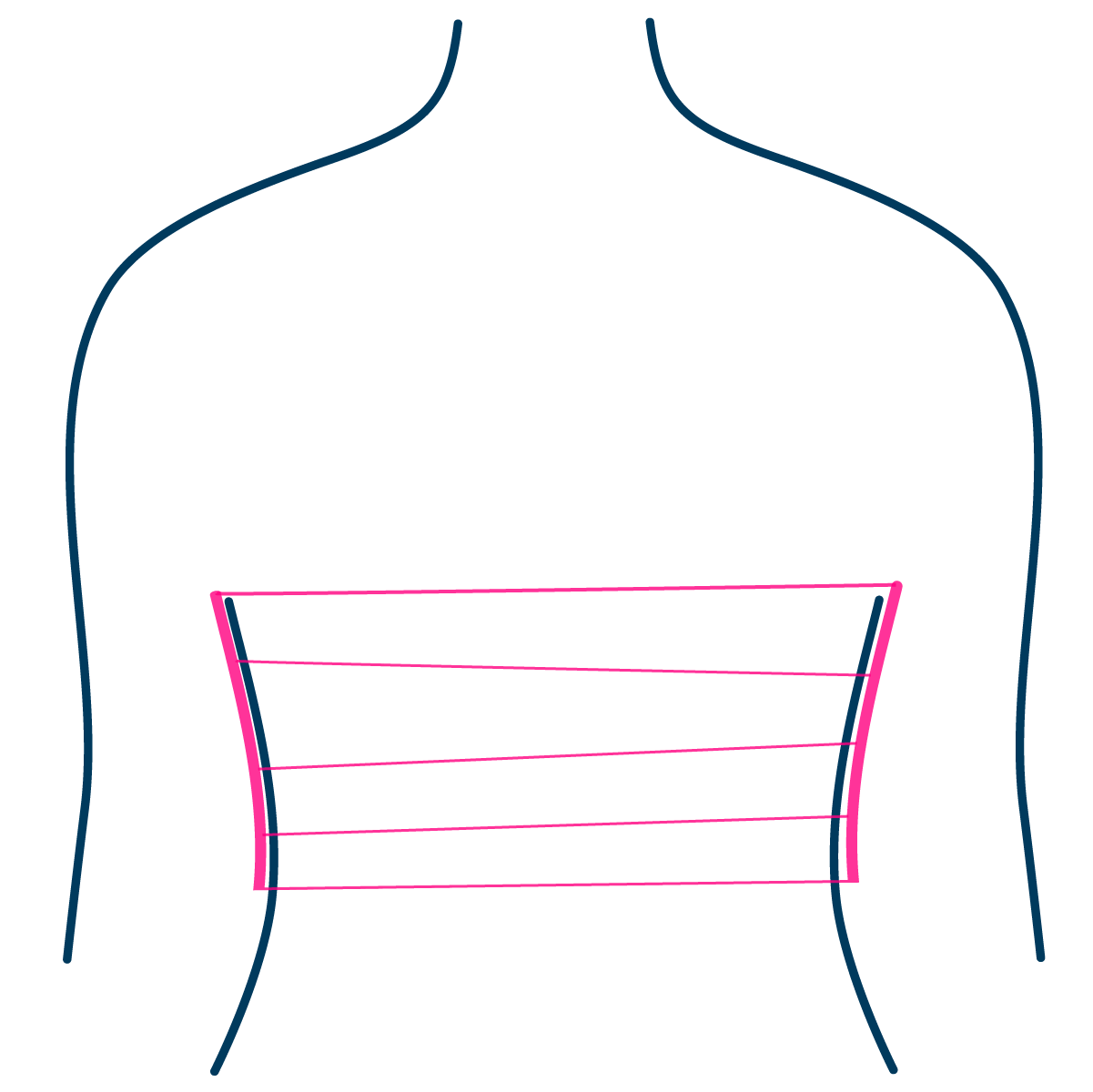 Breast surgery wound care showing bandages across the breasts