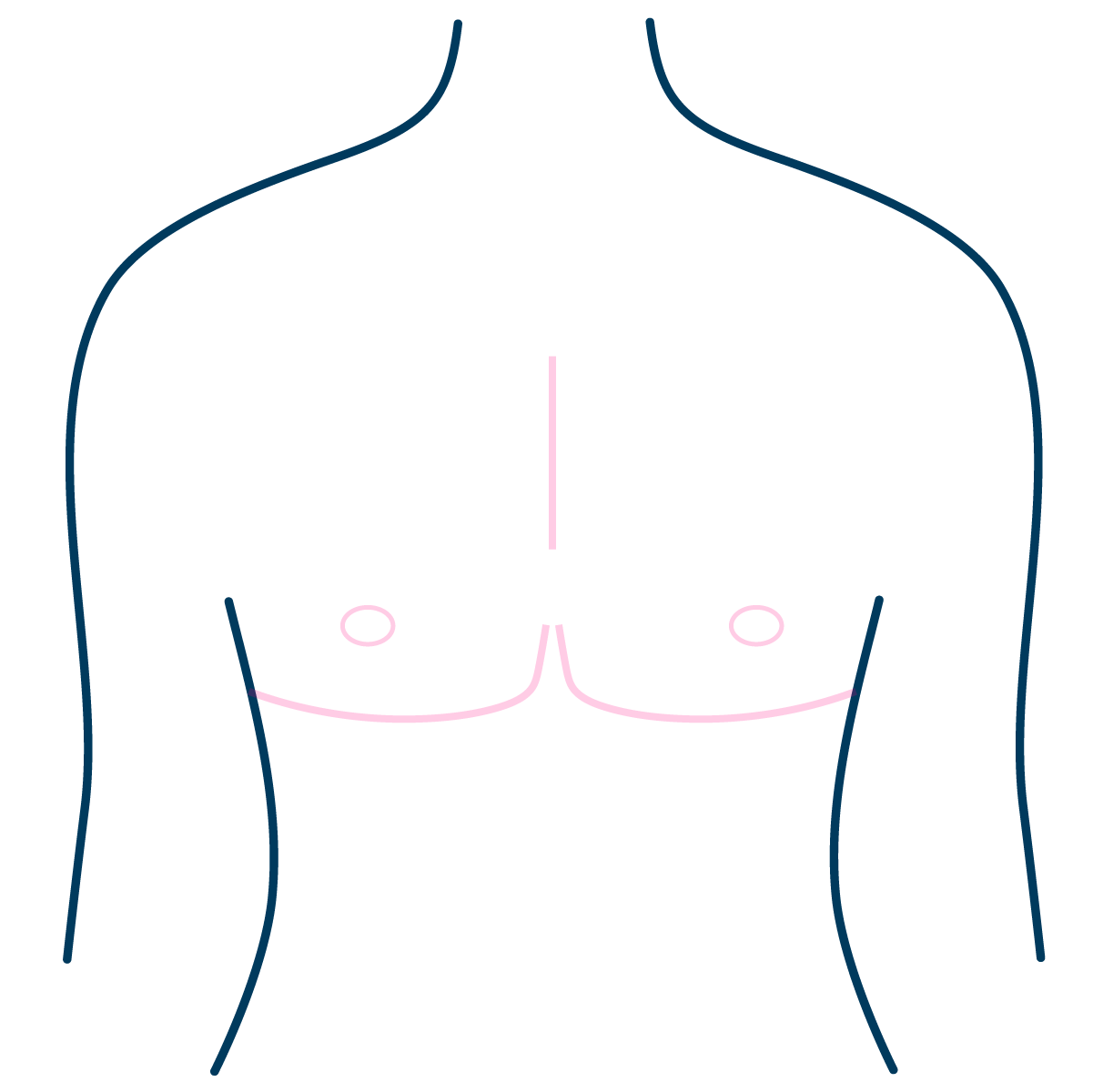 Free Nipple Graft - Complication - Loss of projection